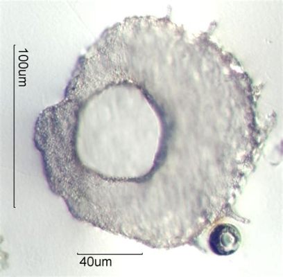  Aculeata! Deze Microscopische Roofdieren met Hun Eigen Springveer Wachten op hun Prooi