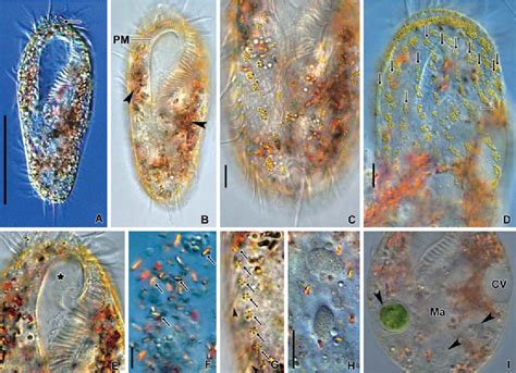  Oxytricha! Een Ciliate Met Twee Kernsystemen en een Talent voor Vermomming